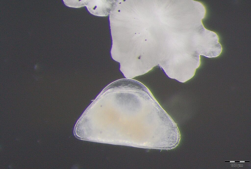 photo au microscope de Schellencandona danielopoli : on voit une masse triangulaire blanchâtre avec les bords transparents sur fond noir